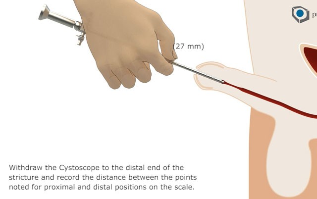 Instruction for use-image