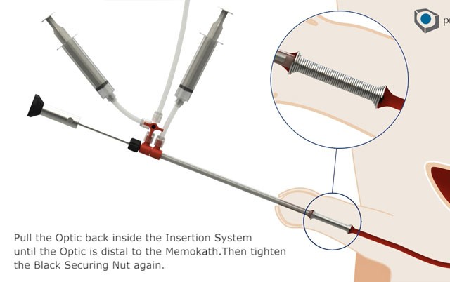 Instruction for use-image
